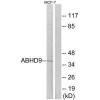 EPHX3 Antibody PACO22114