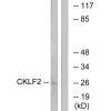 CMTM2 Antibody PACO22272