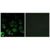 MBTPS2 Antibody PACO22411