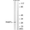 RAB29 Antibody PACO22558