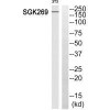 PEAK1 Antibody PACO22664
