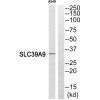 SLC39A9 Antibody PACO22700