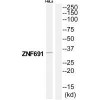 ZNF691 Antibody PACO22713