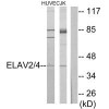 ELAVL2/ELAVL4 Antibody PACO23213