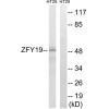 ZFYVE19 Antibody PACO23501