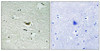 Phospho-CSNK1A1/CSNK1A1L Tyr294 Antibody PACO24388