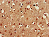 CXorf1 Antibody PACO26053