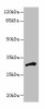 DHRS12 Antibody PACO26233