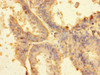 RNF103 Antibody PACO29532