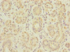 SLC5A10 Antibody PACO29968
