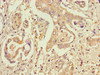 STT3A Antibody PACO30190