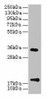 TMEM91 Antibody PACO30658