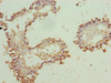 ZNF184 Antibody PACO31184