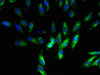 UQCR11 Antibody PACO31752