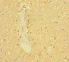 SLC6A7 Antibody PACO31816