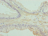 ACTG2 Antibody PACO33260