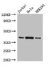 HLA-C Antibody PACO33564
