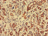 RTCA Antibody PACO35094