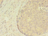 ATXN7L3 Antibody PACO35314