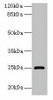 RAB32 Antibody PACO35498
