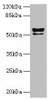 KRT72 Antibody PACO35590