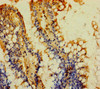 MOGAT2 Antibody PACO35962
