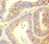 TTLL9 Antibody PACO35982