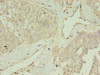 CCDC14 Antibody PACO36018