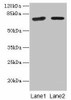 KLHL22 Antibody PACO36114