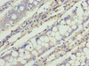 CATSPERE Antibody PACO36402