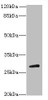 TBC1D26 Antibody PACO37298
