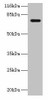 KBTBD2 Antibody PACO37710