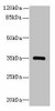 STX19 Antibody PACO38254