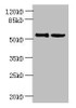 UTP15 Antibody PACO38838