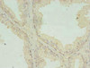 CNOT9 Antibody PACO38898