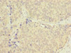 TSACC Antibody PACO38918