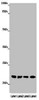 ABHD14B Antibody PACO38986