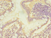 CMBL Antibody PACO39282