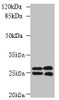 CMBL Antibody PACO39282