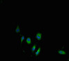 Cbs Antibody PACO39514