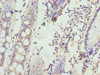 SPTLC3 Antibody PACO40658