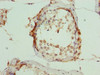 ARMT1 Antibody PACO40822