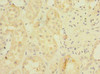 BDH2 Antibody PACO41254