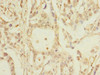 PKD2L2 Antibody PACO41754