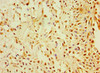 CALR3 Antibody PACO43696