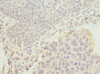 DRAM2 Antibody PACO44803