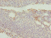 DRAM2 Antibody PACO44804