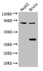 FIGN Antibody PACO47414