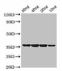 dps Antibody PACO52138