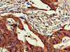 ZNF816 Antibody PACO52290